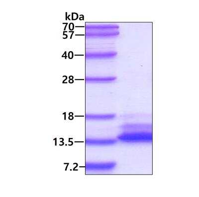 SDS-PAGE: Recombinant Human SAMD13 His Protein [NBP2-22831]