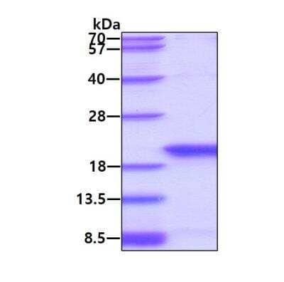 SDS-PAGE: Recombinant Human SAP18 His Protein [NBC1-28776]