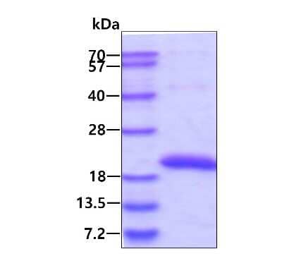 SDS-PAGE: Recombinant Human SAT2 His Protein [NBP1-99074]