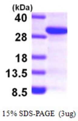 SDS-PAGE: Recombinant Human SCAND1 His Protein [NBP1-49447]