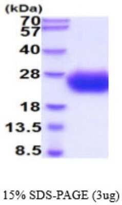 SDS-PAGE: Recombinant Human SCN3B His Protein [NBP2-59531]