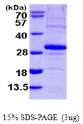 SDS-PAGE: Recombinant Human SCO2 His Protein [NBP1-50951]