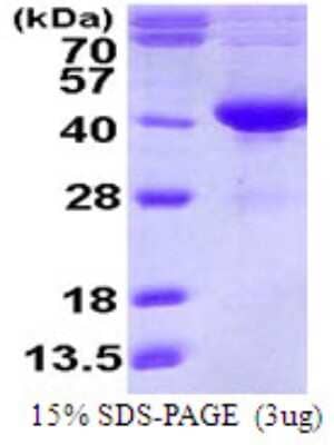 SDS-PAGE: Recombinant Human SDSL His Protein [NBP1-72486]