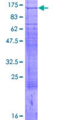 SDS-PAGE: Recombinant Human SERCA1 ATPase GST (N-Term) Protein [H00000487-P01]