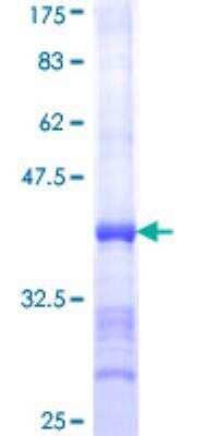 SDS-PAGE: Recombinant Human SERCA1 ATPase GST (N-Term) Protein [H00000487-Q01]