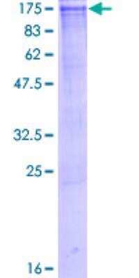 SDS-PAGE: Recombinant Human SERCA2 ATPase GST (N-Term) Protein [H00000488-P01]