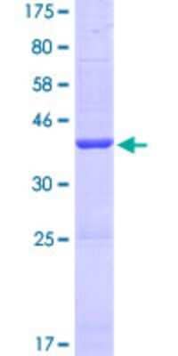 SDS-PAGE: Recombinant Human SERHL GST (N-Term) Protein [H00094009-P01]