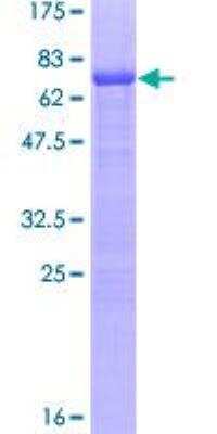 SDS-PAGE: Recombinant Human SF-1/NR5A1/Steroidogenic Factor 1 GST (N-Term) Protein [H00002516-P01]