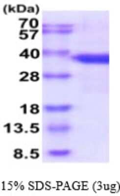 SDS-PAGE: Recombinant Human SF2 His Protein [NBP2-59579]