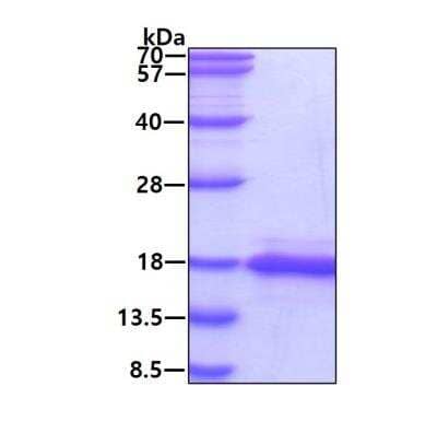 SDS-PAGE: Recombinant Human SH2D1A His Protein [NBP1-50869]