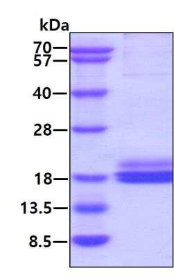 SDS-PAGE: Recombinant Human SH2D1B His Protein [NBP2-60211]