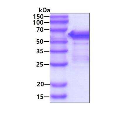 SDS-PAGE: Recombinant Human SHC1 His Protein [NBP1-72374]