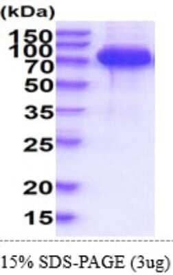 SDS-PAGE: Recombinant Human SLP-76/LCP2 His Protein [NBP2-61206]