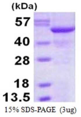 SDS-PAGE: Recombinant Human SIL1 His Protein [NBP1-98949]