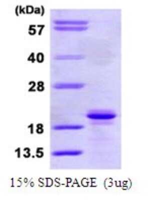 SDS-PAGE: Recombinant Human SIT1 His Protein [NBP1-72451]