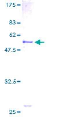 SDS-PAGE: Recombinant Human SLC25A20 GST (N-Term) Protein [H00000788-P01]