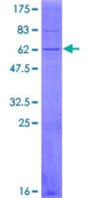 SDS-PAGE: Recombinant Human SLC25A6 GST (N-Term) Protein [H00000293-P02]