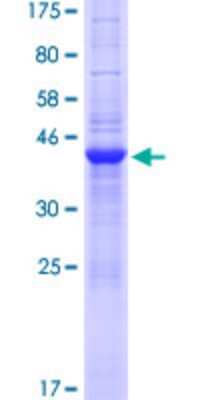 SDS-PAGE: Recombinant Human SLX1A GST (N-Term) Protein [H00548593-P01]