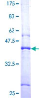 SDS-PAGE: Recombinant Human SMA4 GST (N-Term) Protein [H00011039-P03]