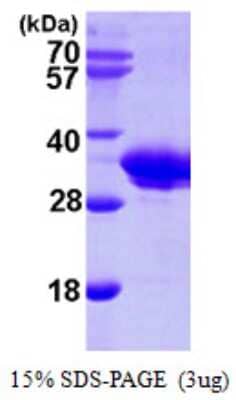 SDS-PAGE: Recombinant Human SMNDC1 His Protein [NBP1-50891]