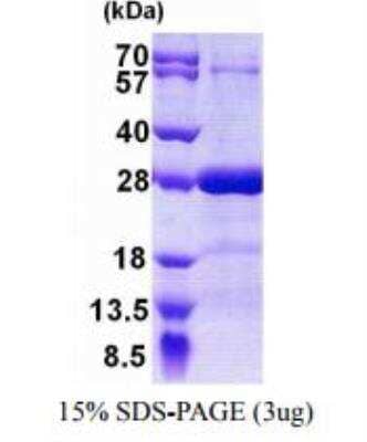 SDS-PAGE: Recombinant Human SNAP25 His Protein [NBC1-18333]