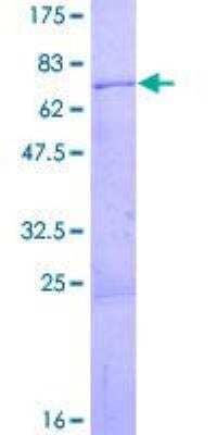 SDS-PAGE: Recombinant Human SNF5 GST (N-Term) Protein [H00006598-P01]