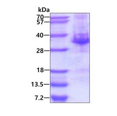 SDS-PAGE: Recombinant Human SNF8 His Protein [NBP1-98935]