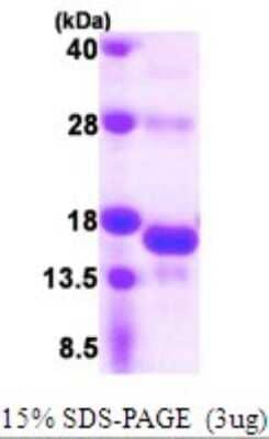 SDS-PAGE: Recombinant Human SNRNP25 His Protein [NBP1-72307]