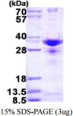 SDS-PAGE: Recombinant Human SNRPA1 His Protein [NBP1-78860]