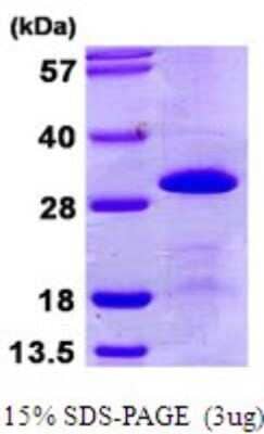 SDS-PAGE: Recombinant Human SNRPB2 His Protein [NBP1-72292]