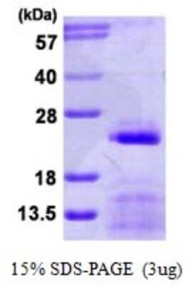 SDS-PAGE: Recombinant Human SNRPC His Protein [NBP1-78822]