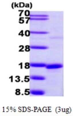 SDS-PAGE: Recombinant Human SNRPD2 His Protein [NBP1-51012]