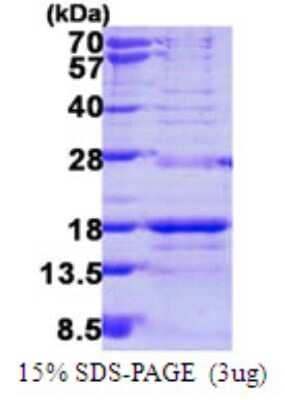 SDS-PAGE: Recombinant Human SNRPD3 His Protein [NBP1-78811]