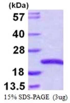 SDS-PAGE: Recombinant Human SNX3 His Protein [NBP1-72347]