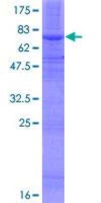 SDS-PAGE: Recombinant Human SOAT 2 GST (N-Term) Protein [H00008435-P01]