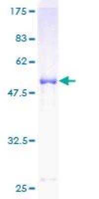 SDS-PAGE: Recombinant Human SOCS-3 GST (N-Term) Protein [H00009021-P01]