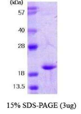 SDS-PAGE: Recombinant Human SOD1/Cu-Zn SOD Protein [NBC1-18544]