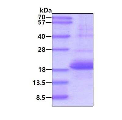 SDS-PAGE: Recombinant Human SP-D His Protein [NBP2-51743]