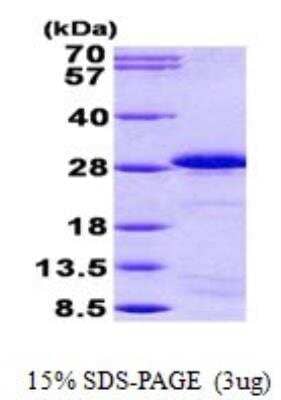 SDS-PAGE: Recombinant Human SP17 His Protein [NBP2-22818]