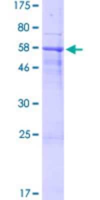 SDS-PAGE: Recombinant Human SPACA1 GST (N-Term) Protein [H00081833-P01]