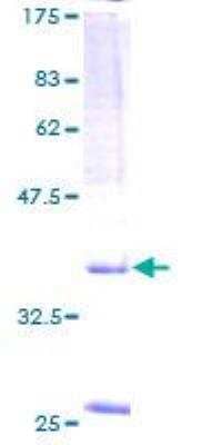 SDS-PAGE: Recombinant Human SPAG9 GST (N-Term) Protein [H00009043-P01]