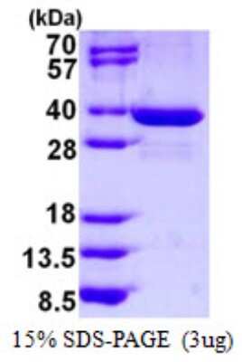 SDS-PAGE: Recombinant Human SPIN1 His Protein [NBP1-98940]