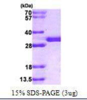 SDS-PAGE: Recombinant Human SPR His Protein [NBC1-21657]