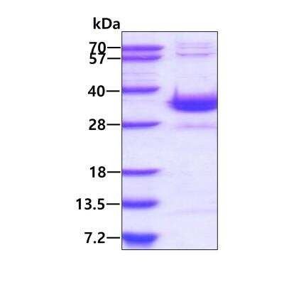 SDS-PAGE: Recombinant Human SPSB2 His Protein [NBP2-22820]