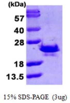 SDS-PAGE: Recombinant Human SRI His Protein [NBP1-51016]