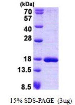 SDS-PAGE: Recombinant Human SSBP1 His Protein [NBP2-22805]