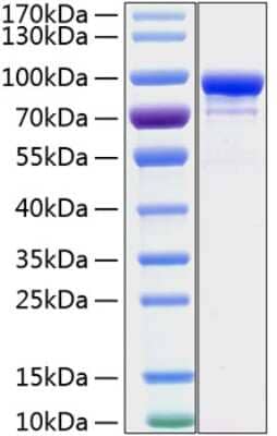 SDS-PAGE: Recombinant Human STAT1 His (C-Term) Protein [NBP3-18204]