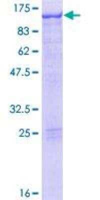 SDS-PAGE: Recombinant Human STAT5A GST (N-Term) Protein [H00006776-P01]