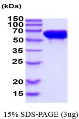 SDS-PAGE: Recombinant Human STI1 Protein [NBP2-49685]