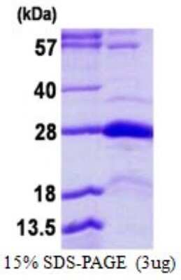 SDS-PAGE: Recombinant Human STYX His Protein [NBP1-99069]